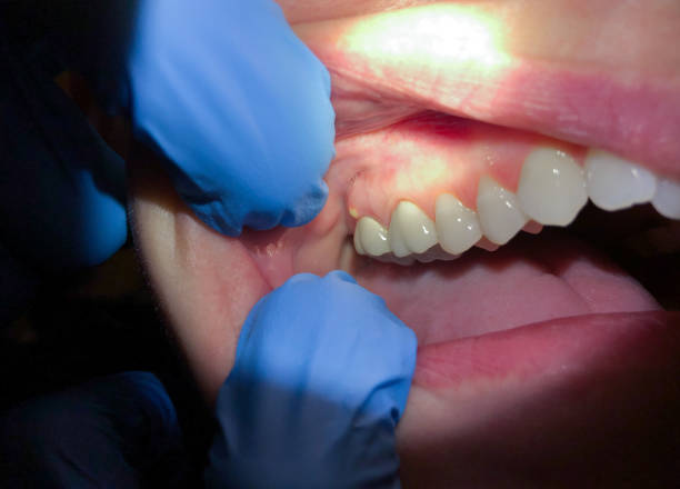 Best Emergency Gum Pain Relief  in Mililani Mauka, HI